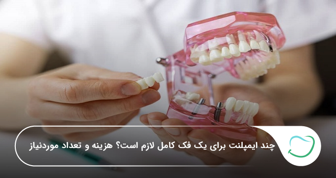 چند ایمپلنت برای یک فک کامل لازم است؟ هزینه و تعداد موردنیاز 🦷【سال1405】❤️ چند ایمپلنت برای یک فک کامل لازم است؟ هزینه و تعداد موردنیاز 🦷【سال1405】❤️