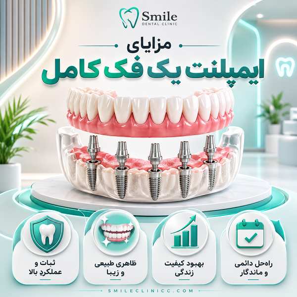 عوامل موثر بر تعداد ایمپلنت برای یک فک کامل