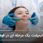 ایمپلنت یک مرحلهای در فولادشهر 🦷【سال1405】❤️ ایمپلنت یک مرحلهای در فولادشهر 🦷【سال1405】❤️
