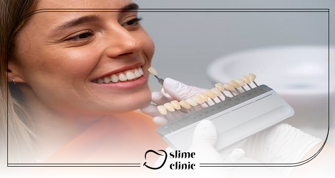 ایمپلنت زیرکونیا در اصفهان چه خصوصیاتی دارد؟
