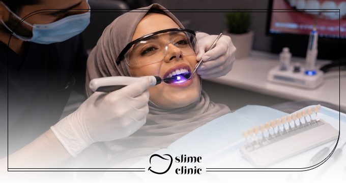 چه زمانی تعویض کامپوزیت لازم است؟