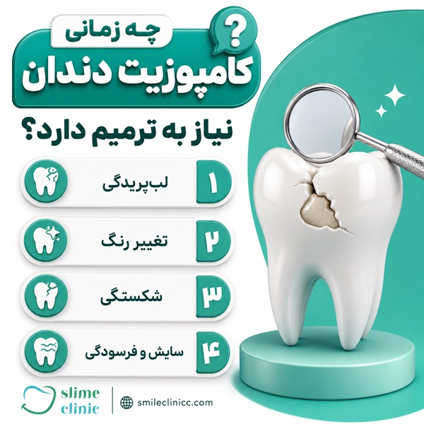 چه زمانی کامپوزیت دندان نیاز به ترمیم دارد؟