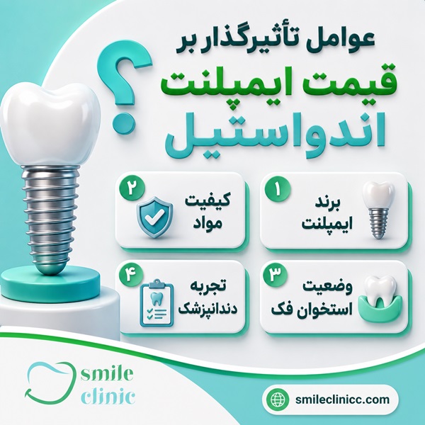 عوامل تأثیرگذار بر قیمت ایمپلنت اندواستیل