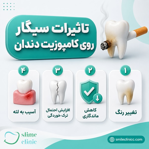 سیگار چه تأثیری روی کامپوزیت دندان دارد؟