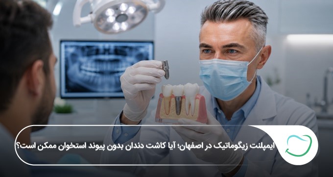 ایمپلنت زیگوماتیک در اصفهان؛ آیا کاشت دندان بدون پیوند استخوان ممکن است؟【1405】 ایمپلنت زیگوماتیک در اصفهان؛ آیا کاشت دندان بدون پیوند استخوان ممکن است؟【1405】
