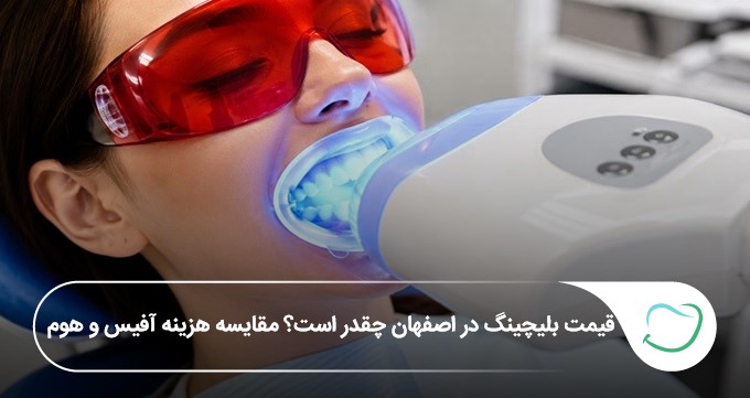 قیمت بلیچینگ در اصفهان چقدر است؟ مقایسه هزینه آفیس و هوم 🦷【سال1405】 قیمت بلیچینگ در اصفهان چقدر است؟ مقایسه هزینه آفیس و هوم 🦷【سال1405】