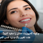 چگونه کامپوزیت دندان را سفید کنیم؟ علت تغییر رنگ و زرد شدن کامپوزیت (سال1405)🦷 چگونه کامپوزیت دندان را سفید کنیم؟ علت تغییر رنگ و زرد شدن کامپوزیت (سال1405)🦷