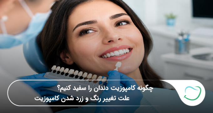 چگونه کامپوزیت دندان را سفید کنیم؟ علت تغییر رنگ و زرد شدن کامپوزیت (سال1405)🦷 چگونه کامپوزیت دندان را سفید کنیم؟ علت تغییر رنگ و زرد شدن کامپوزیت (سال1405)🦷