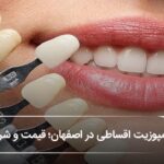 کامپوزیت اقساطی در اصفهان؛ قیمت و شرایط پرداخت (سال1405)🦷 کامپوزیت اقساطی در اصفهان؛ قیمت و شرایط پرداخت (سال1405)🦷