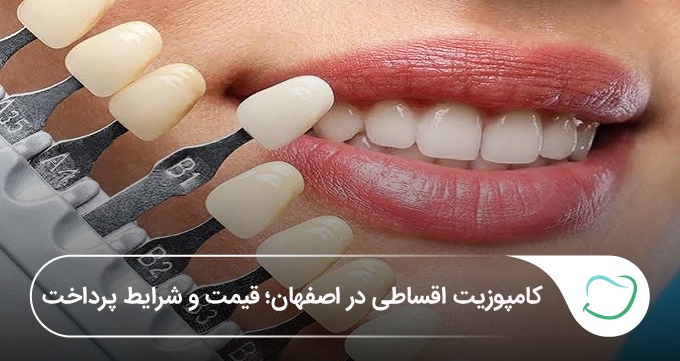 کامپوزیت اقساطی در اصفهان؛ قیمت و شرایط پرداخت (سال1405)🦷 کامپوزیت اقساطی در اصفهان؛ قیمت و شرایط پرداخت (سال1405)🦷