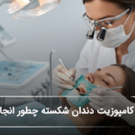 کامپوزیت دندان شکسته چطور انجام میشود؟ (سال1405)🦷 کامپوزیت دندان شکسته چطور انجام میشود؟ (سال1405)🦷