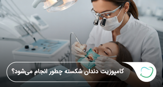کامپوزیت دندان شکسته چطور انجام میشود؟ (سال1405)🦷 کامپوزیت دندان شکسته چطور انجام میشود؟ (سال1405)🦷