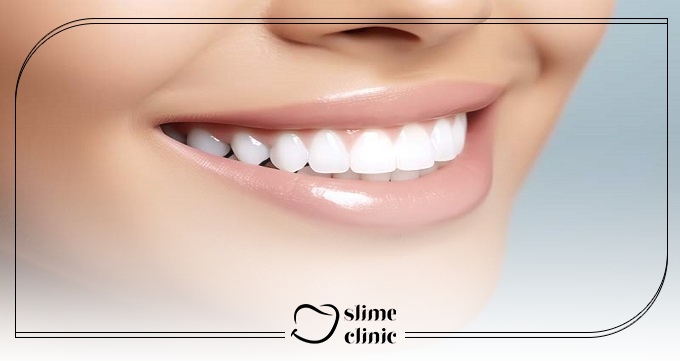 آیا اصلاح طرح لبخند ارزش هزینه کردن دارد؟