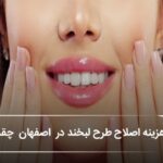 هزینه اصلاح طرح لبخند در اصفهان چقدر است؟ بررسی قیمت روشها (سال1405)🦷 هزینه اصلاح طرح لبخند در اصفهان چقدر است؟ بررسی قیمت روشها (سال1405)🦷