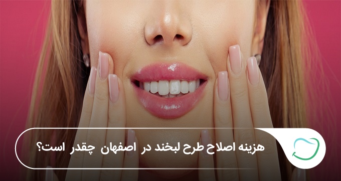 هزینه اصلاح طرح لبخند در اصفهان چقدر است؟ بررسی قیمت روشها (سال1405)🦷 هزینه اصلاح طرح لبخند در اصفهان چقدر است؟ بررسی قیمت روشها (سال1405)🦷
