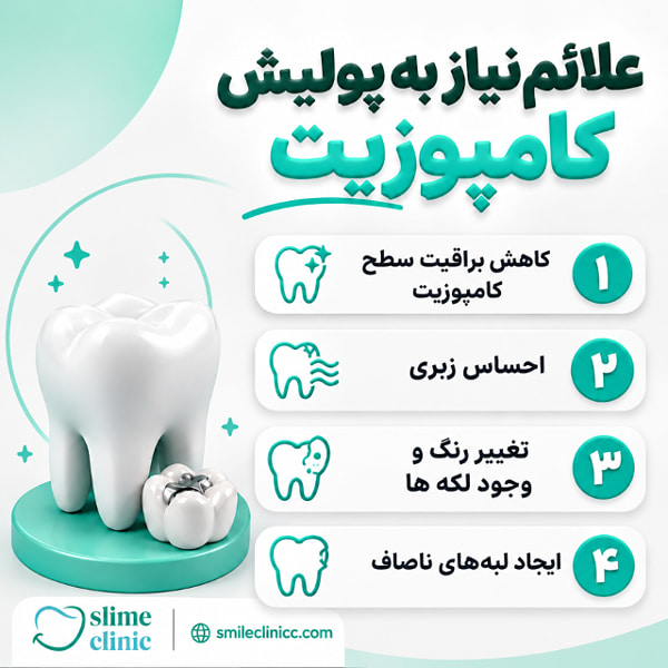 علائم تعیین کننده نیاز به پولیش کامپوزیت