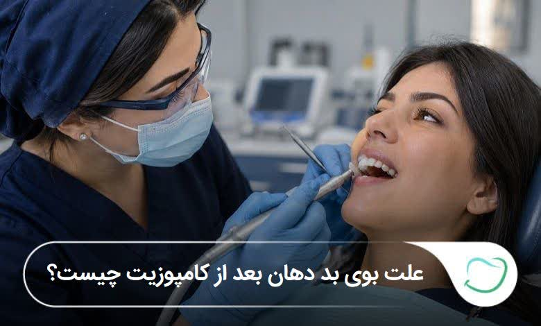 علت بوی بد دهان بعد از کامپوزیت چیست؟ ⭐️(سال1405) علت بوی بد دهان بعد از کامپوزیت چیست؟ ⭐️(سال1405)