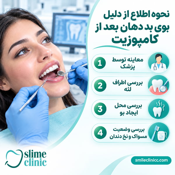 بررسی مهمترین علت بوی بد دهان بعد از کامپوزیت