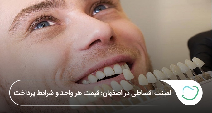 لمینت اقساطی در اصفهان؛ قیمت هر واحد و شرایط پرداخت (سال1405)🦷 لمینت اقساطی در اصفهان؛ قیمت هر واحد و شرایط پرداخت (سال1405)🦷