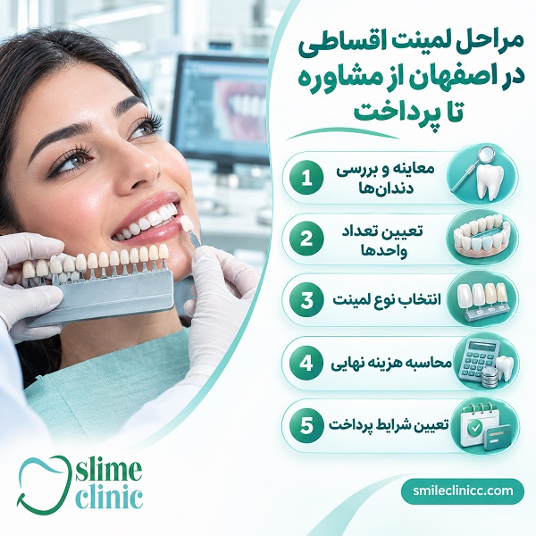 لمینت اقساطی در اصفهان برای چه کسانی مناسب است؟