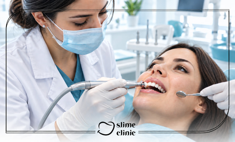 چه زمانی پولیش کافی نیست و نیاز به ترمیم یا تعویض ونیر داریم؟