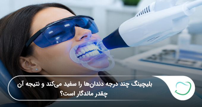 بلیچینگ دندان چند درجه دندانها را سفید میکند و چقدر ماندگار است؟ (سال1405)🦷 بلیچینگ دندان چند درجه دندانها را سفید میکند و چقدر ماندگار است؟ (سال1405)🦷