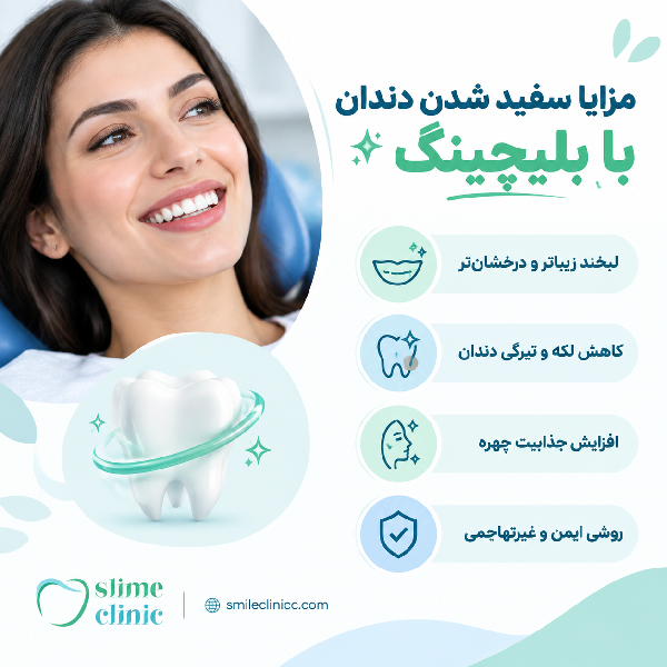 سفید شدن دندان با بلیچینگ