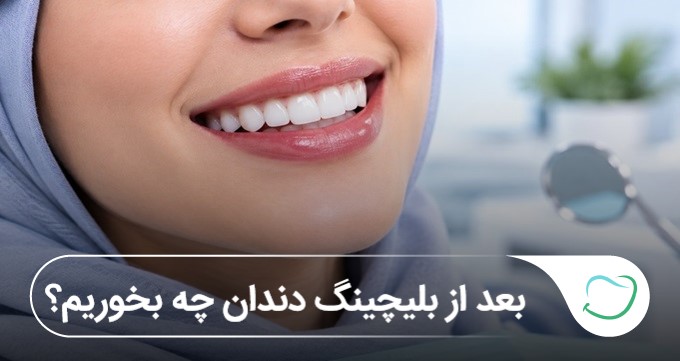 بعد از بلیچینگ دندان چه بخوریم؟ رژیم غذایی سفید بعد از بلیچینگ (سال1405)⭐️ بعد از بلیچینگ دندان چه بخوریم؟ رژیم غذایی سفید بعد از بلیچینگ (سال1405)⭐️