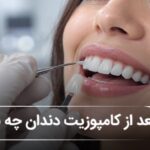 بعد از کامپوزیت دندان چه بخوریم؟ بایدها و نبایدهای غذایی بعد از کامپوزیت(سال1405)⭐️ بعد از کامپوزیت دندان چه بخوریم؟ بایدها و نبایدهای غذایی بعد از کامپوزیت(سال1405)⭐️