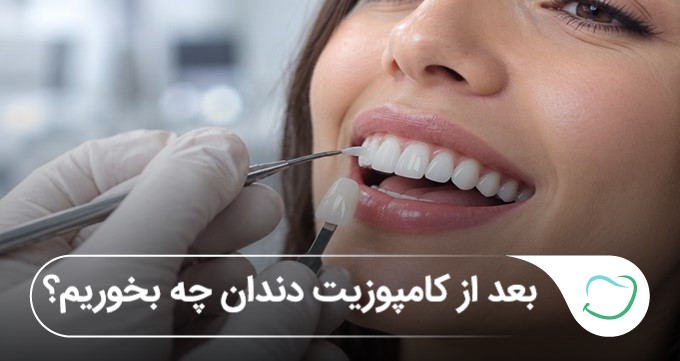 بعد از کامپوزیت دندان چه بخوریم؟ بایدها و نبایدهای غذایی بعد از کامپوزیت(سال1405)⭐️ بعد از کامپوزیت دندان چه بخوریم؟ بایدها و نبایدهای غذایی بعد از کامپوزیت(سال1405)⭐️